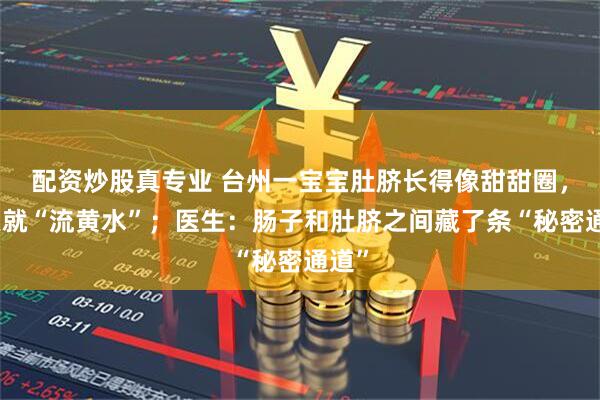 配资炒股真专业 台州一宝宝肚脐长得像甜甜圈，一哭就“流黄水”；医生：肠子和肚脐之间藏了条“秘密通道”
